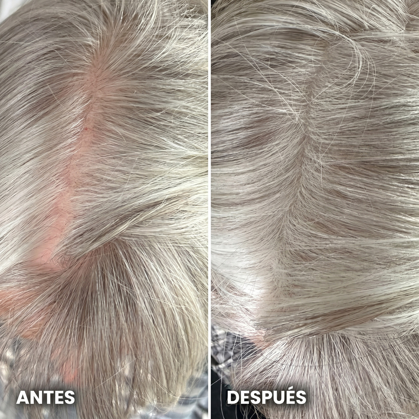 KeraCover™ Polvo Corrector Capilar
